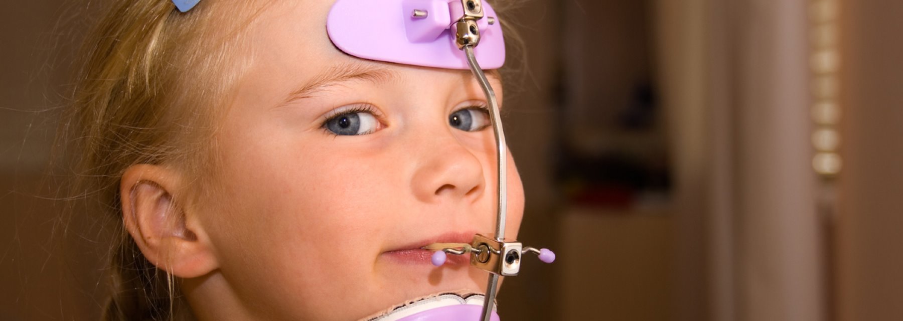 Orthodontic Headgear